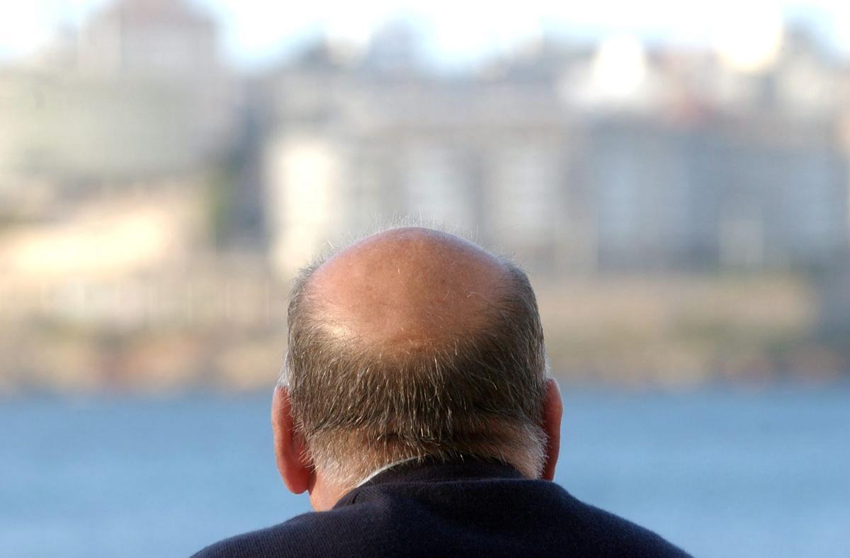La alopecia androgénica afectará en algún momento de su vida al 80 % de los hombres