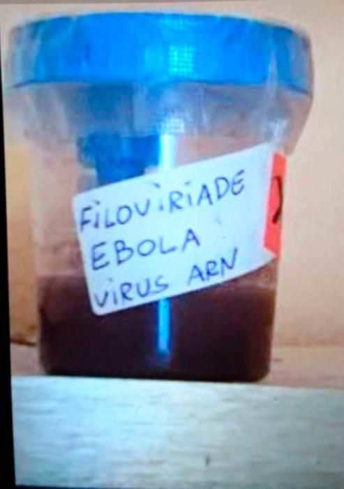 Activan la alerta ébola por el hallazgo de un bote con sangre en Palma