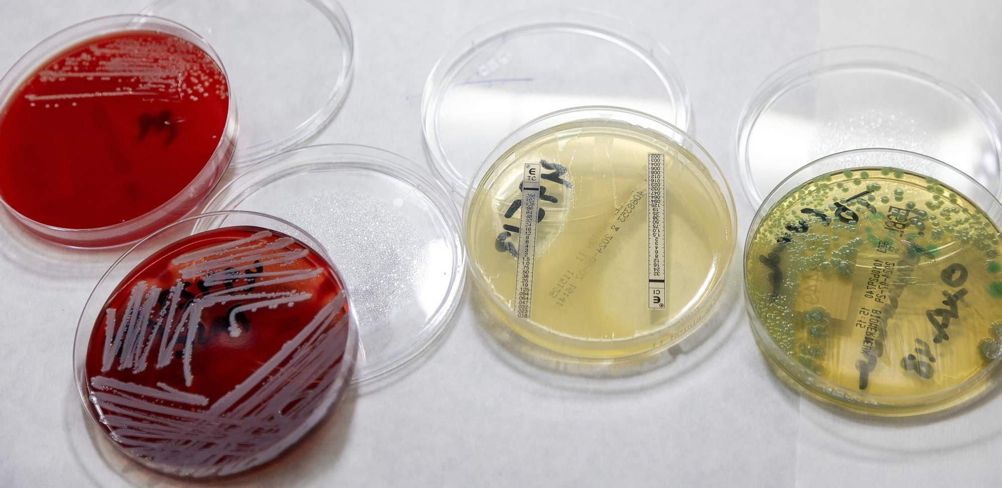 Protocolo para optimizar la respuesta rápida en código sepsis en Alicante