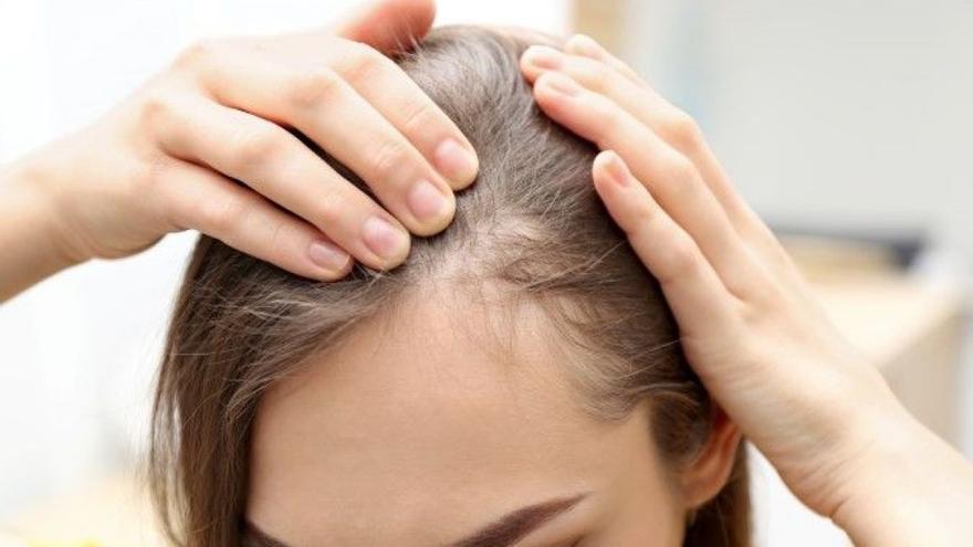 El estrés es una de las causas de la alopecia por efluvio telógeno