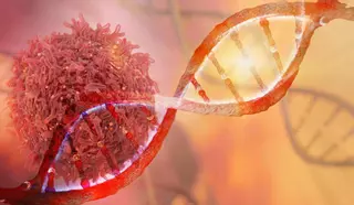 Un test genómico predice qué pacientes con cáncer responderán a la inmunoterapia