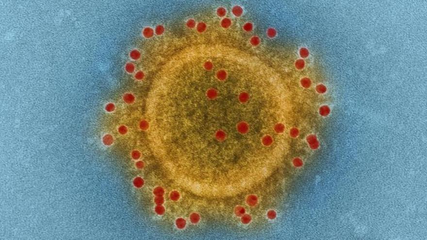 Coronavirus.