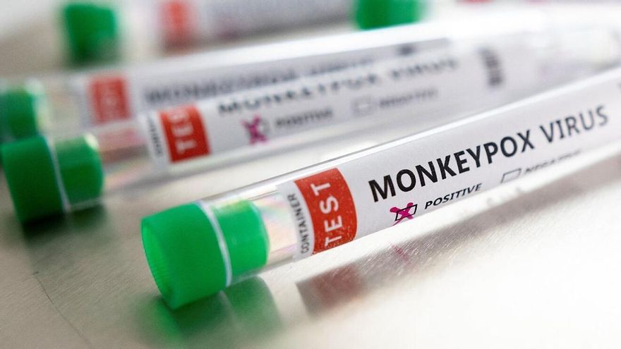 Descartan que la nueva variante de mpox esté detrás del último caso de la Región