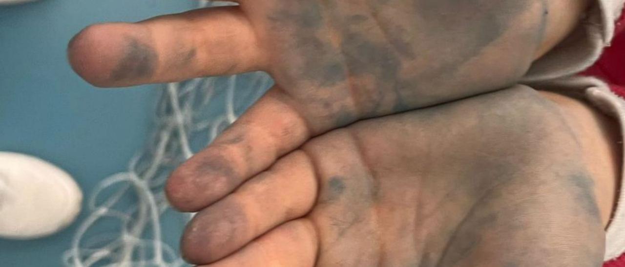 Manos de un niño teñidas de azul en la pista de A Xunqueira.