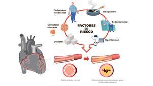 Factores de riesgo para sufrir una enfermedad coronaria