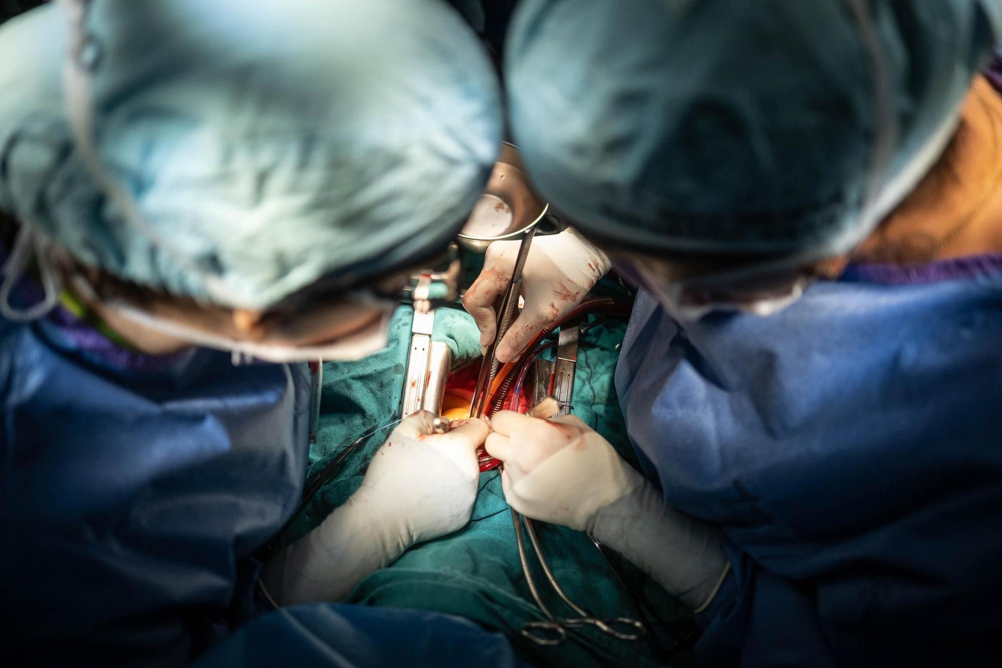 Realización de una cirugía extracorpórea enel HUC