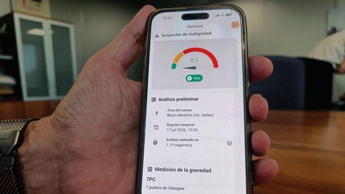 La nueva herramienta de inteligencia artificial para el análisis de lesiones dermatológicas