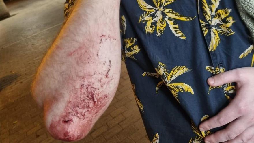 La víctima muestra las heridas en el rostro y brazo.