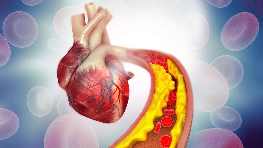 Colesterol alto: los alimentos que debes eliminar y los mejores para controlar los niveles