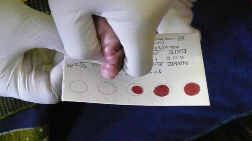 Nova investigació amb nadons amb VIH