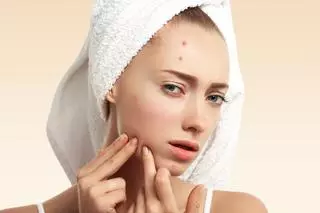 Piel radiante y sin imperfecciones con este limpiador de poros eléctrico