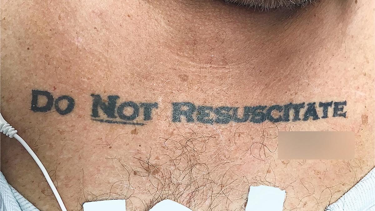 Un tatuaje de 'no resucitar' abre un debate médico