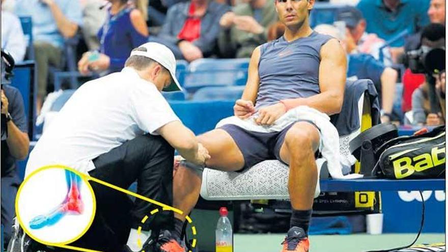 El 5 de noviembre el manacorí es sometido a una artroscopia en el tobillo derecho después de retirarse del Masters 1.000 de París-Bercy.