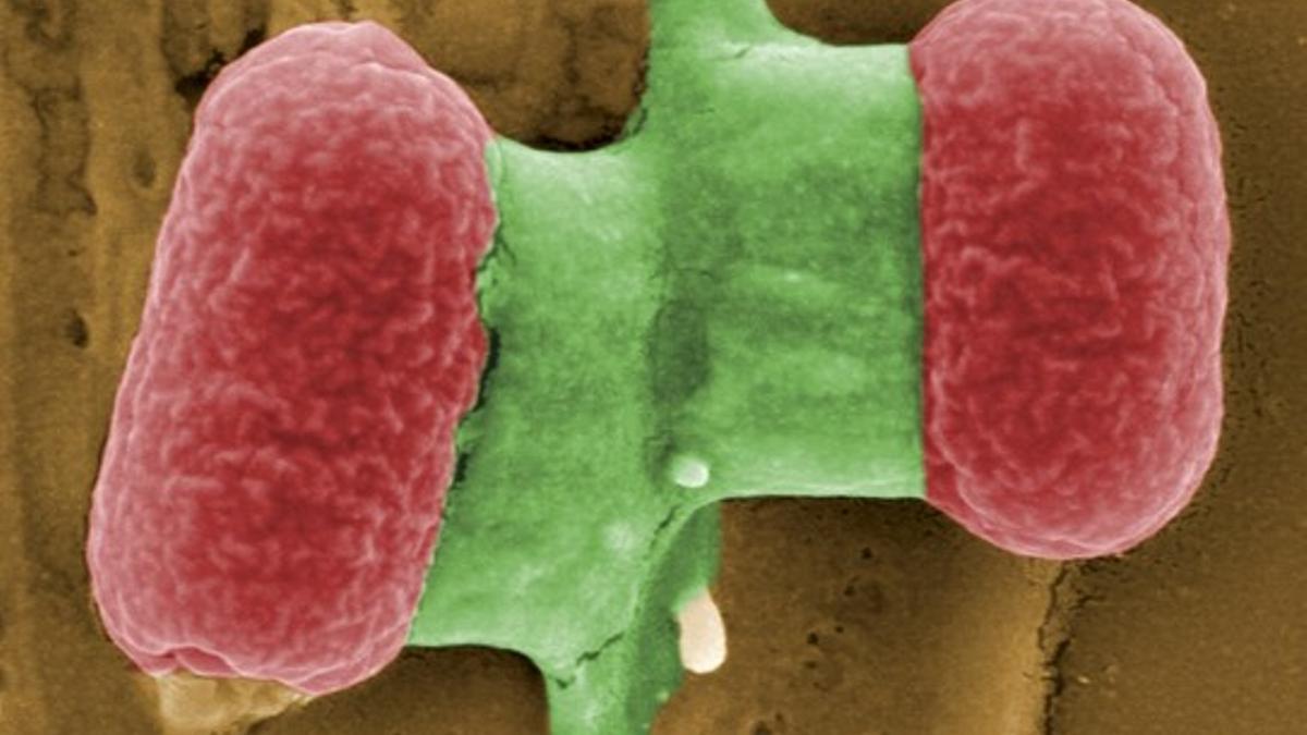 Bacterias escherichia coli vistas con un microscopio electrónico.