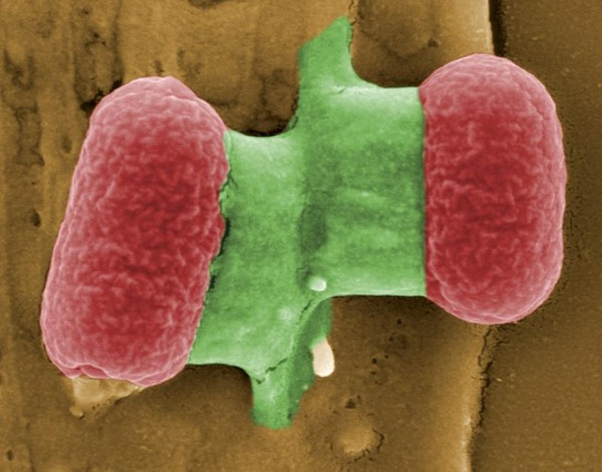 Bacteris escherichia coli vistos amb un microscopi electrònic.