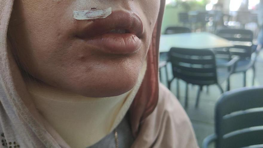 Les dones musulmanes agredides a Manresa: "Tenim por que ens ho tornin a fer"