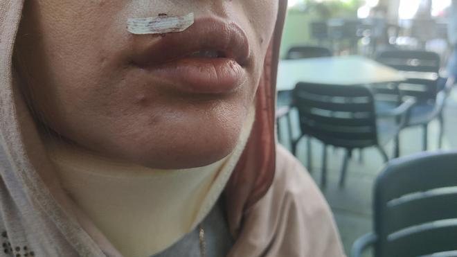 Las mujeres musulmanas agredidas en Manresa: «Tenemos miedo de que nos lo vuelvan a hacer»