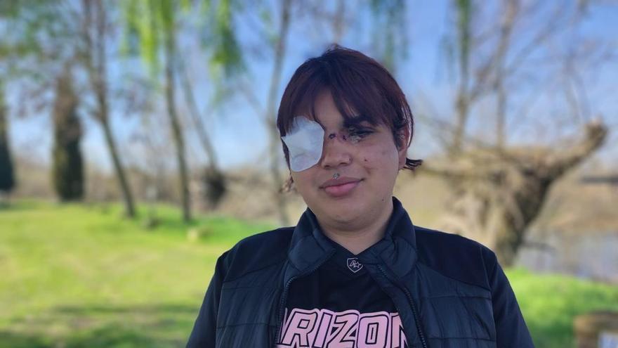 “De los insultos a los botellazos»: así fue la agresión múltiple a Bianca Lizbeth Fernández en León