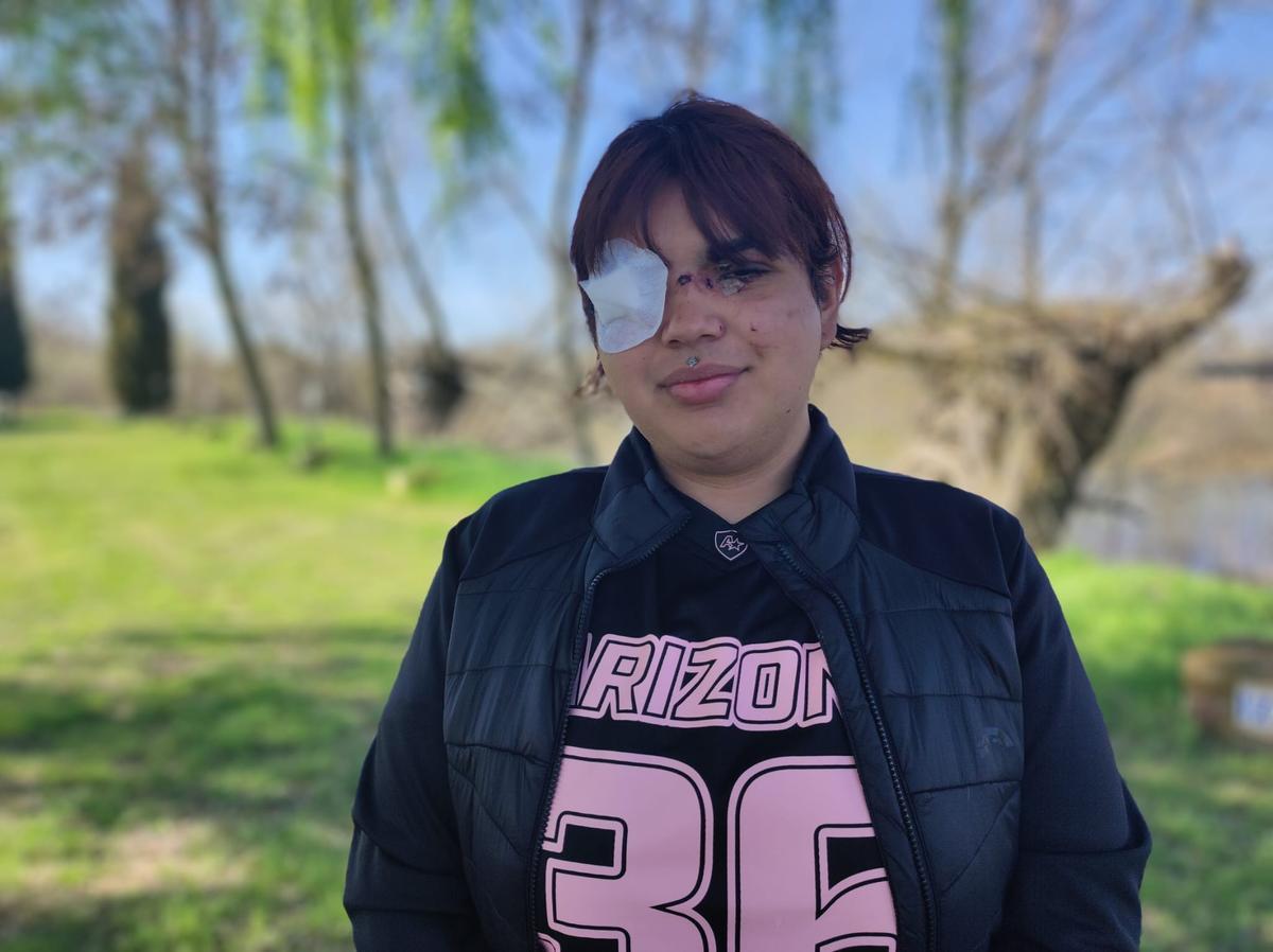 Entrevista a Bianca Lizbeth, la joven benaventana agredida en La Bañeza.