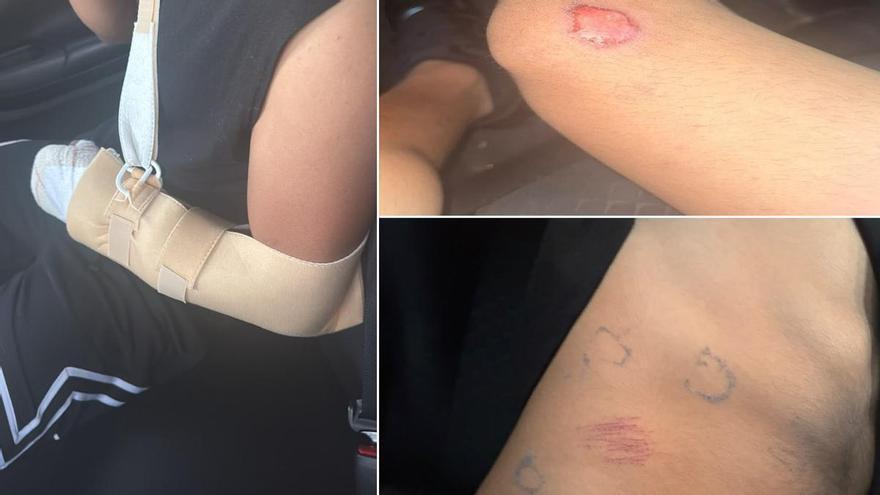 Un grupo de jóvenes apaliza a un menor y golpea un vehículo estacionado con una señal de stop en Vecindario