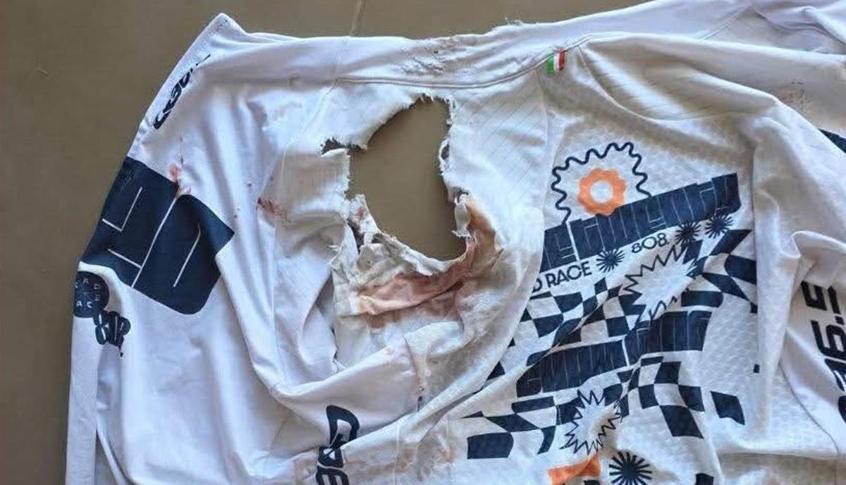 Así quedó el maillot del ciclista golpeado por la furgoneta