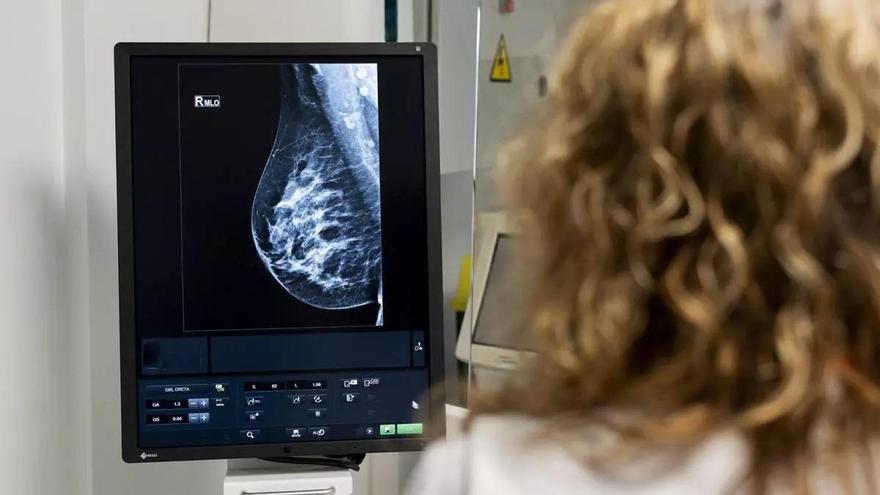 Asturias planta cara al cáncer de mama: las asturianas, entre las que más participan en los programas de cribado, que se ampliará hasta las de 74 años