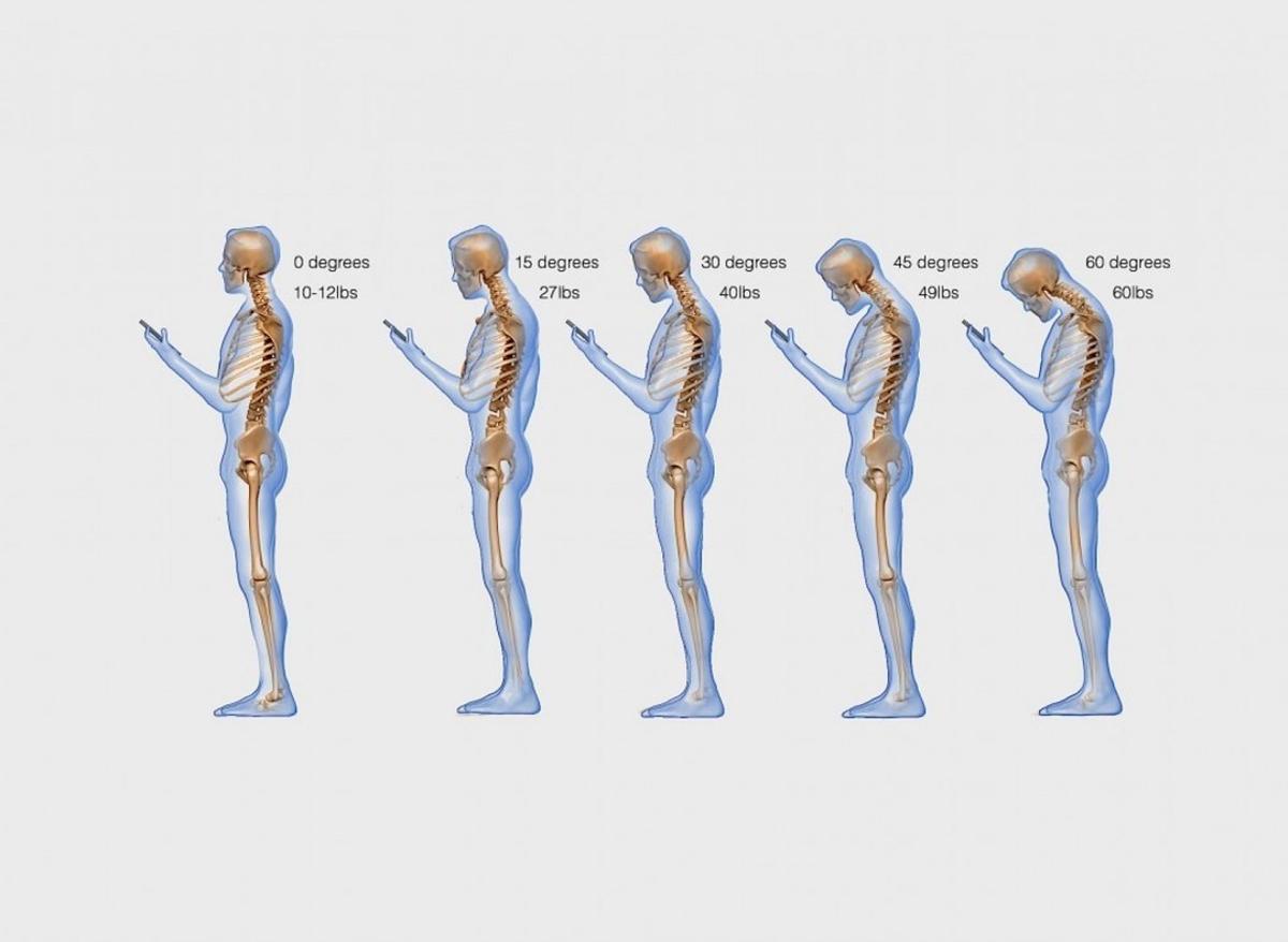 cervicales-centro-de-ciruga-y-rehabilitacin-de-la-columna-vertebral-de-nueva-york-