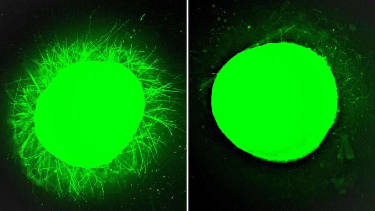 Mayor crecimiento de neuritas de un organoide de la médula espinal humana tratado con moléculas de movimiento rápido o “moléculas bailarinas” (izquierda), en comparación con uno tratado con moléculas de movimiento lento (derecha).