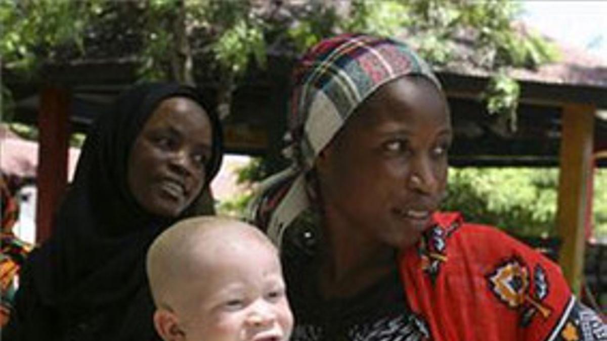 Una madre espera junto a su hijo albino para registrarlo en la Sociedad Albina de Tanzania y así protegerlo.