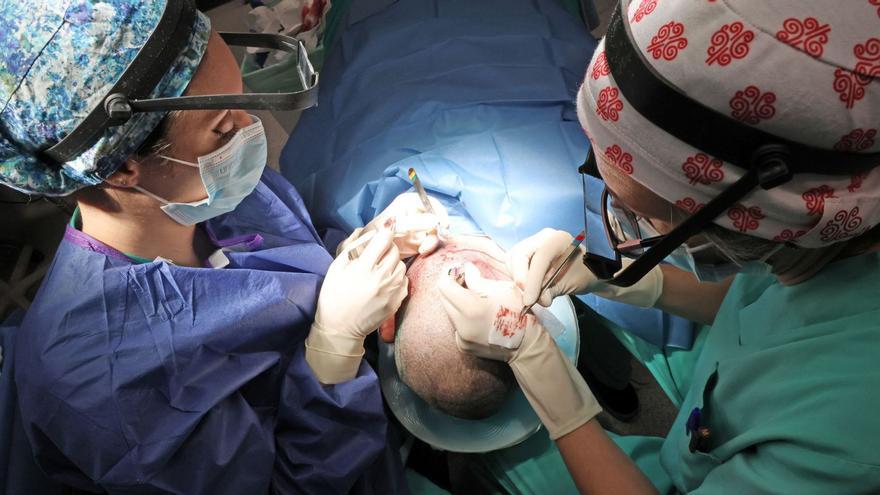 Profesionales de Povisa introduciendo los folículos en la zona receptora de la cabeza de un paciente en una intervención del mes pasado.
