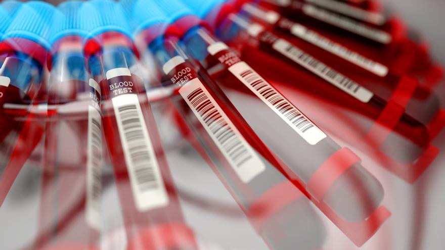 A liquid biopsy helps diagnose colorectal cancer