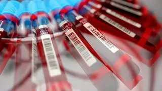 Un estudio identifica posibles marcadores de covid persistente en la sangre