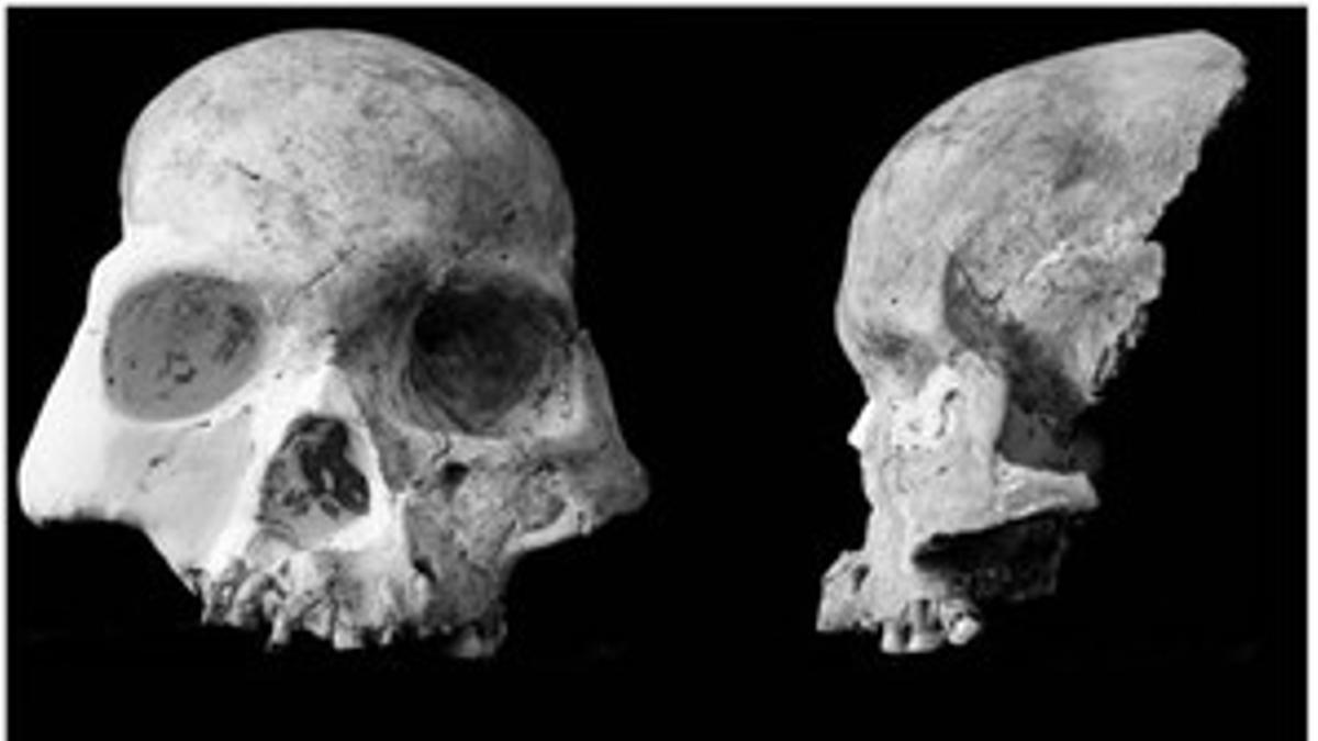 Restos de huesos hallados en China de un hombre que vivió hace unos 14.000 años.