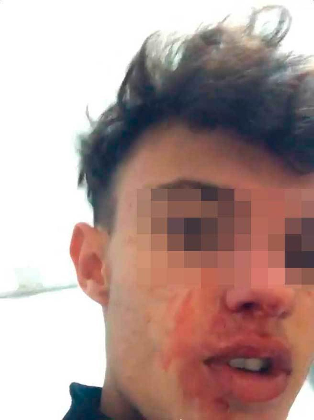 Monumental tangana en un partido de juveniles en Campos