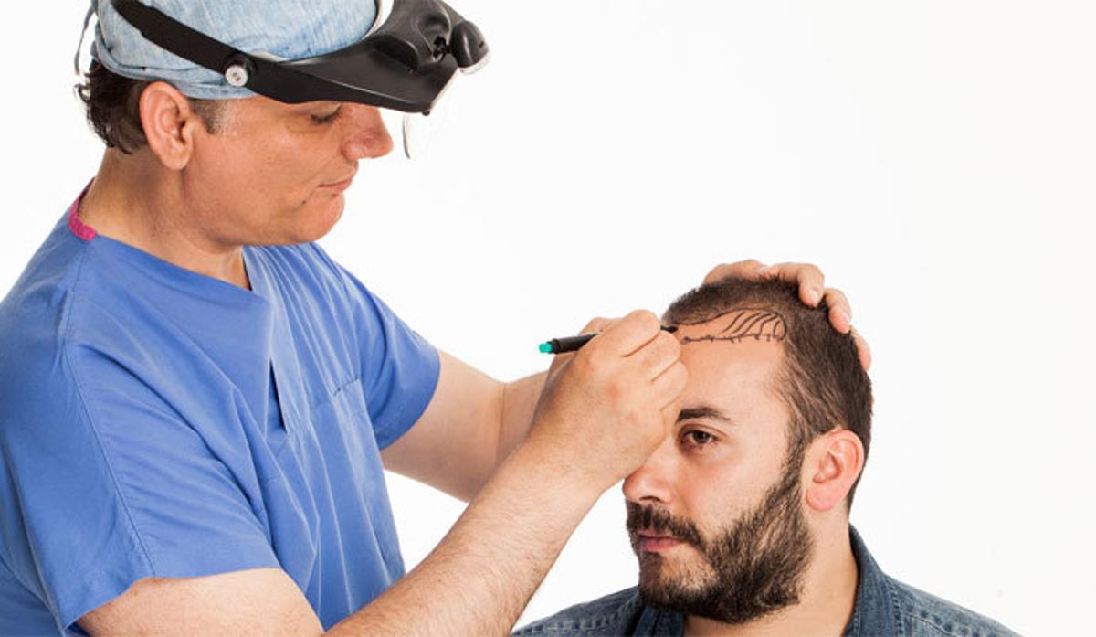 Caída del cabello: ¿Cuándo debes preocuparte?