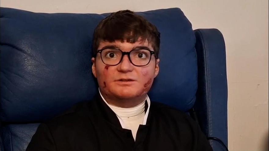 Adrián Soto paciente con 'Piel de Mariposa': 