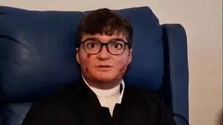 Adrián Soto paciente con 'Piel de Mariposa': "Tengo el deseo de que todo funcione bien"