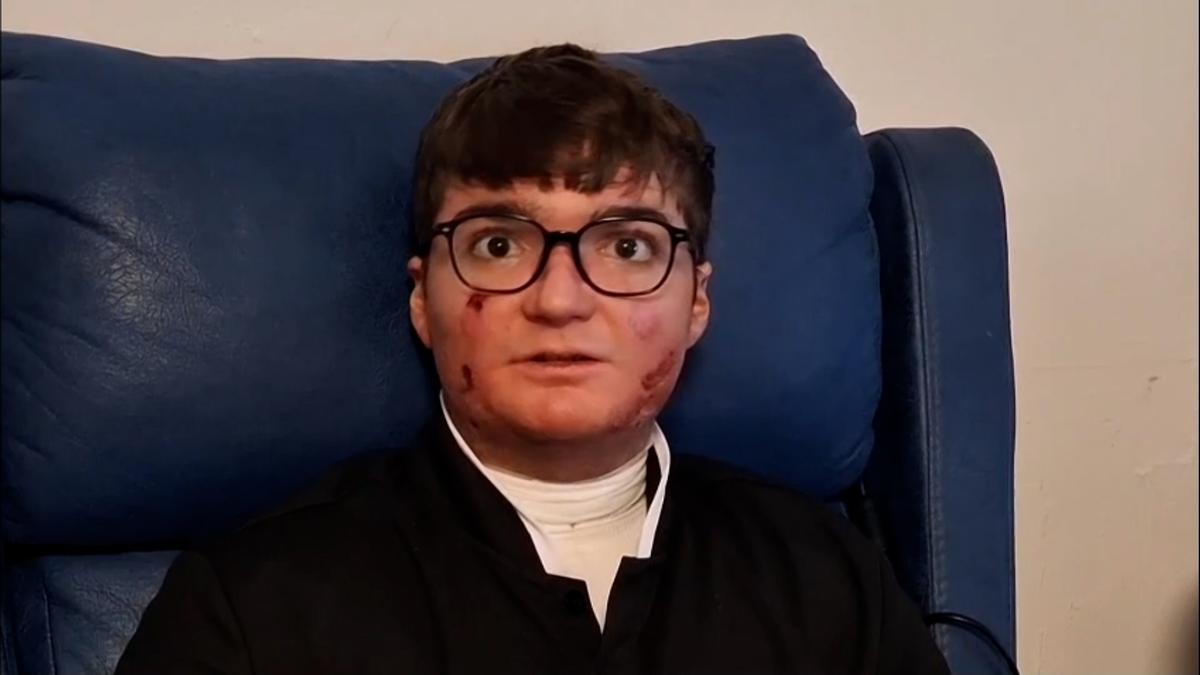 Adrián Soto paciente con 'Piel de Mariposa': "Tengo el deseo de que todo funcione bien"