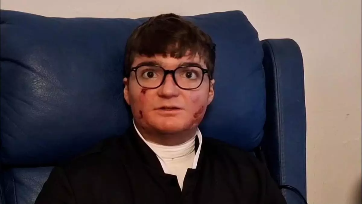 Adrián Soto paciente con 'Piel de Mariposa': "Tengo el deseo de que todo funcione bien"