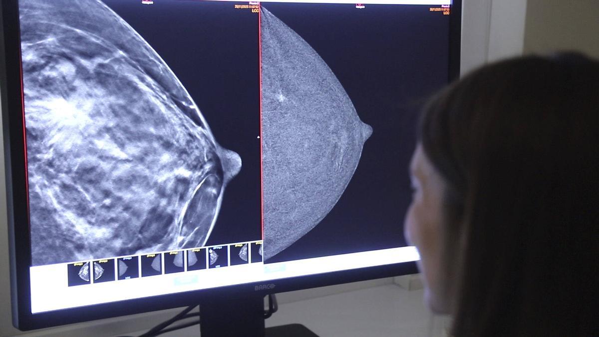 Resultado de una mamografía.