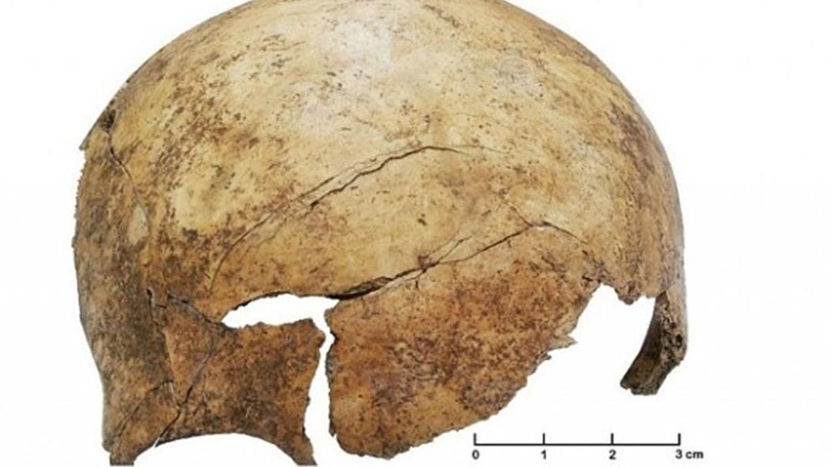 Cráneo de un niño del Paleolítico con un golpe violento.