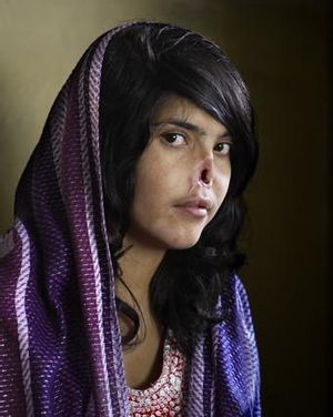 La fotografia guanyadora d’aquesta edició, de la sud-africana Jodi Bieber, immortalitza Bibi Aisha, una noia afganesa de 18 anys que va ser mutilada com a càstig per fugir de la casa del seu marit a la província d’Oruzgan, al centre de l’Afganistan.