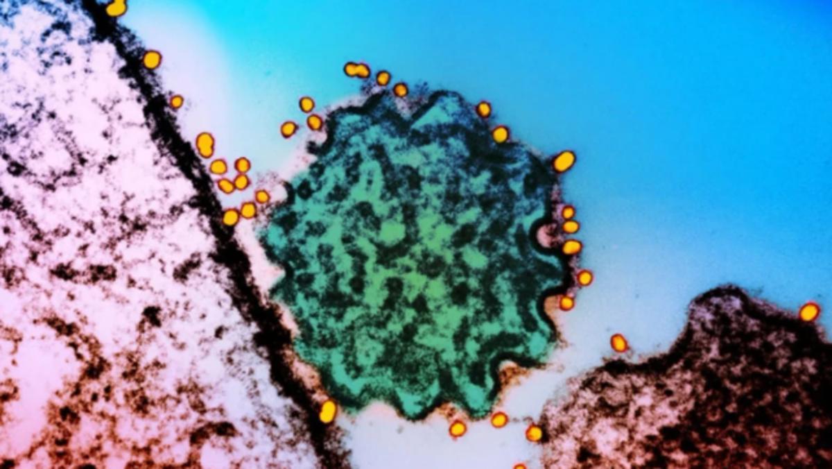 Así es el letal virus Nipah, que ha causado varios muertos en la India y pone en alerta a la OMS