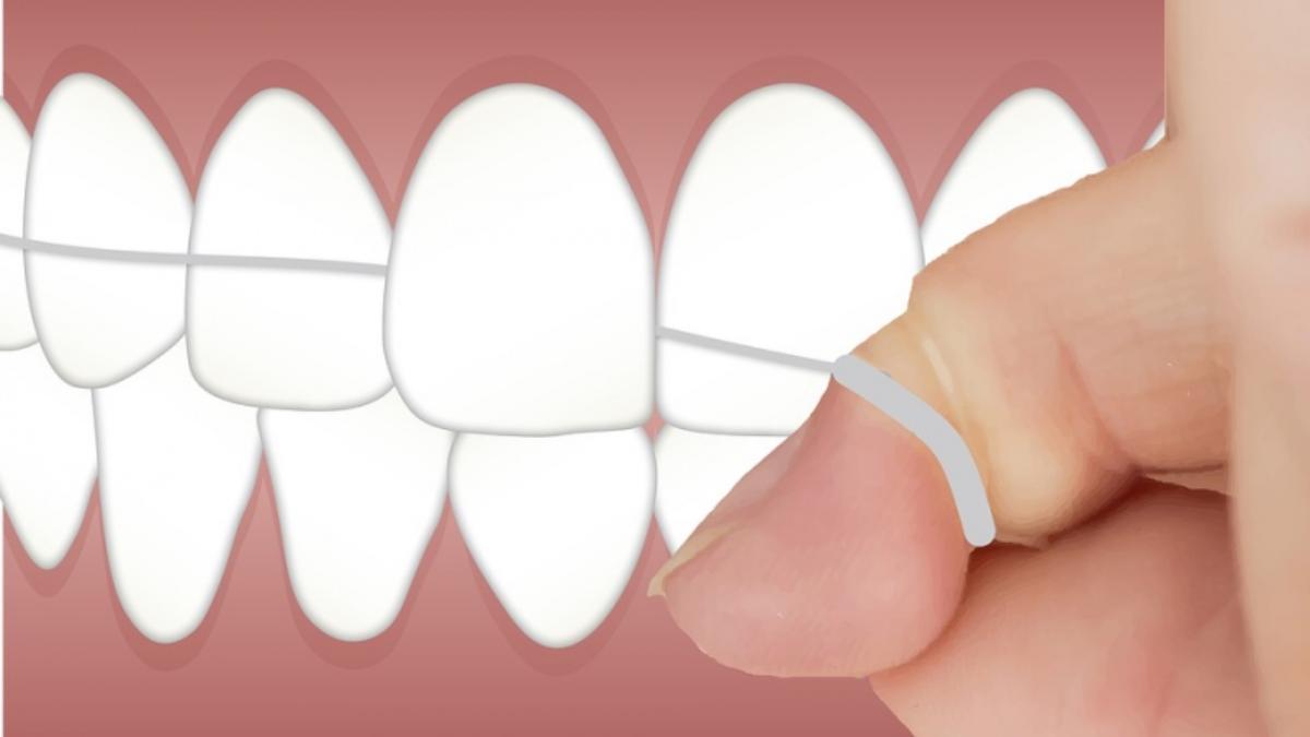 Las múltiples ventajas del hilo dental