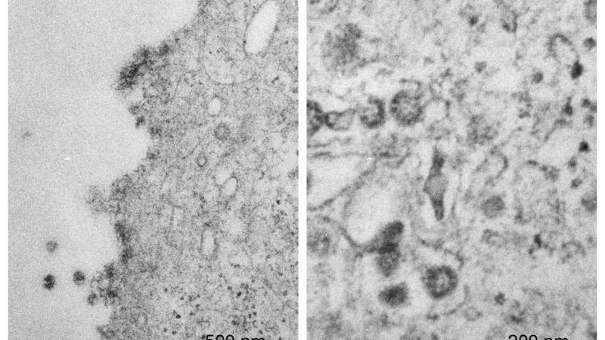 Unizar consigue imágenes microscópicas del SARS-CoV-2