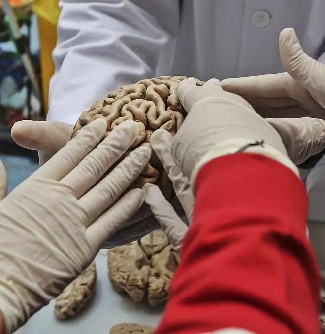 Una investigación de la UMH identifica la causa de tumores en el cerebro de los niños