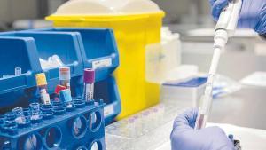 Biomarcadores de alzhéimer en una muestra de sangre.