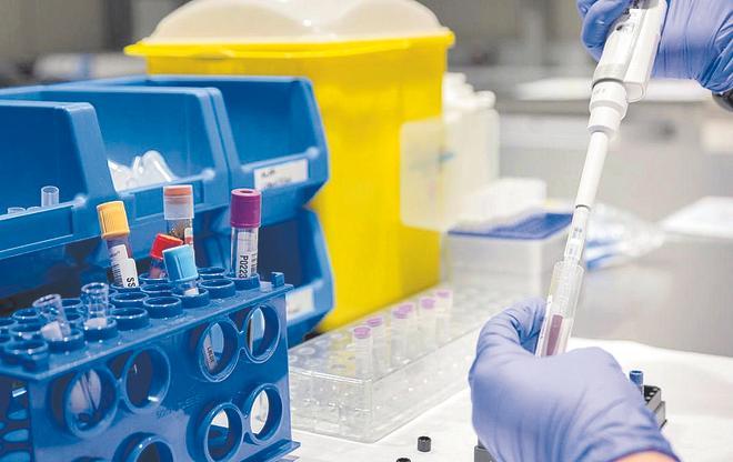 Los biomarcadores digitales en alzhéimer evaluarán la memoria, el lenguaje y los movimientos del paciente a través del móvil
