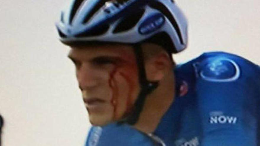 Kittel, sangrando tras el puñetazo.