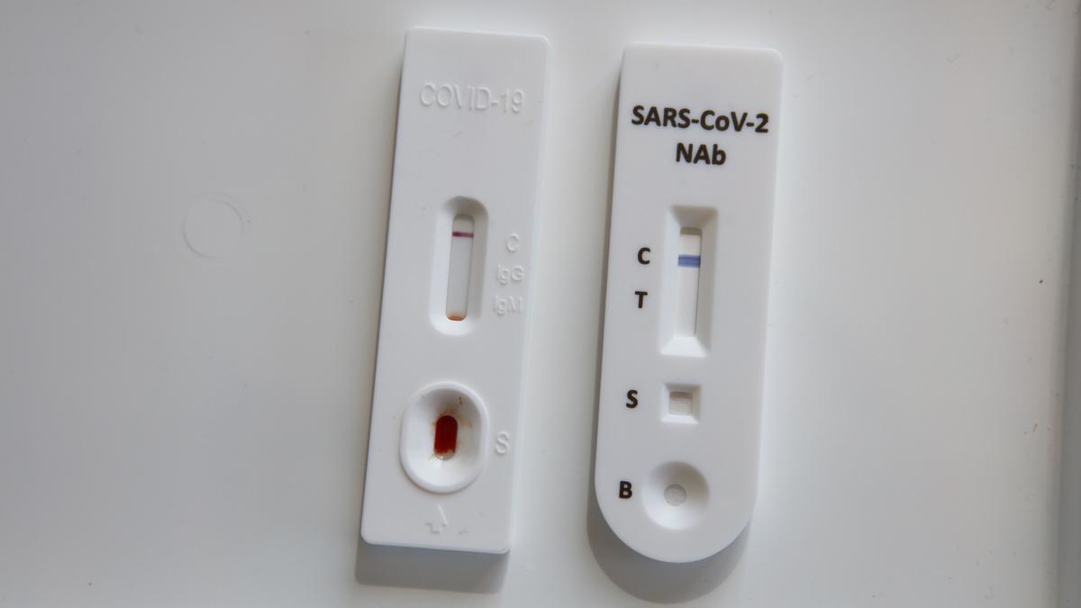 Antikörpertests sehen auf den ersten Blick aus wie Antigen-Schnelltests.